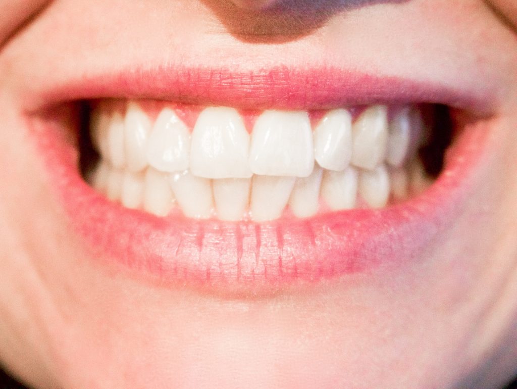 ENSURING THAT TEETH WHITENING IS SAFE