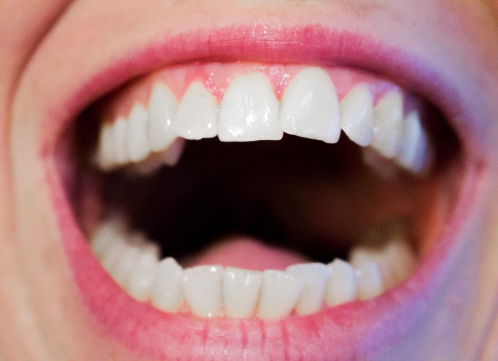The Perils of Having Crooked Teeth-min