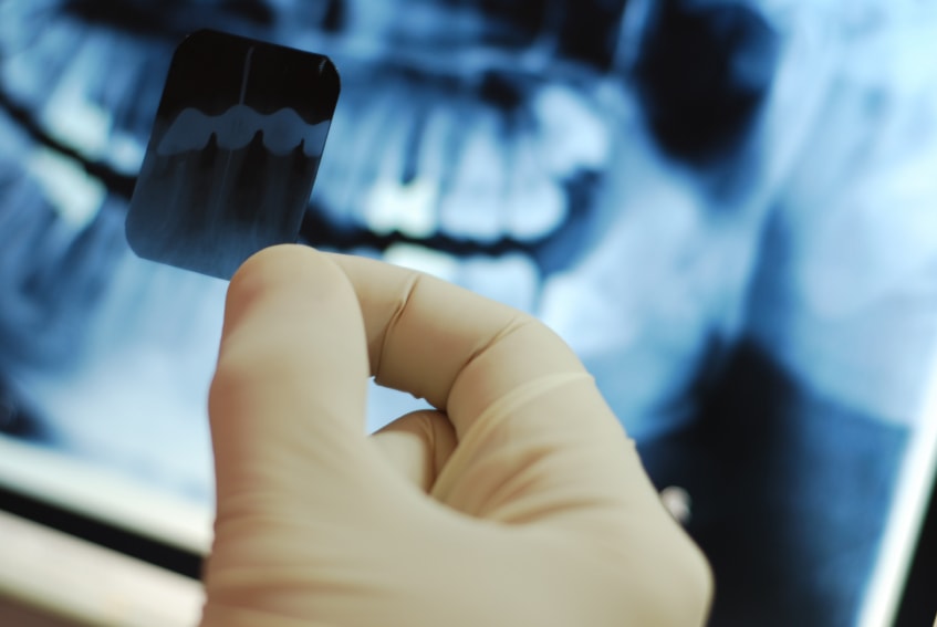 The Significance of Dental XRays in Dentistry-min