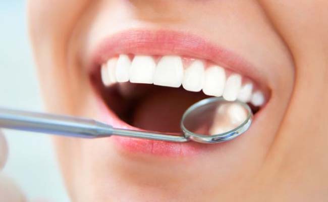 Why Consider Professional Teeth Cleaning-min