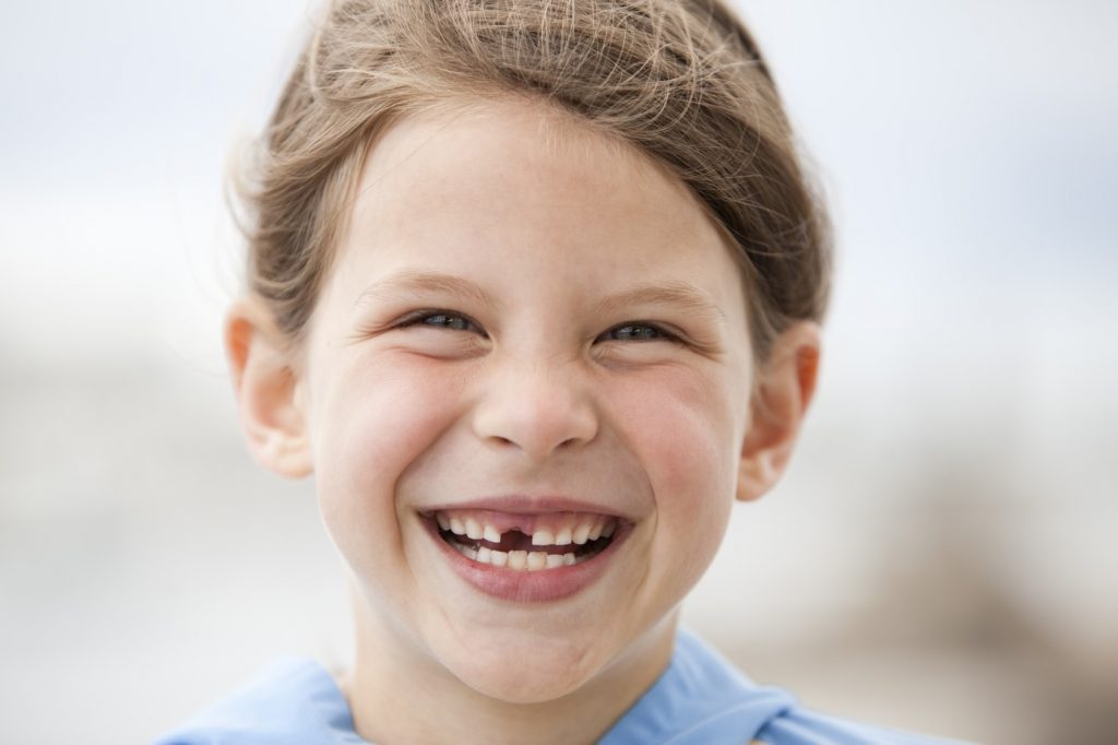 Dental Sealants protecting your childs teeth-min