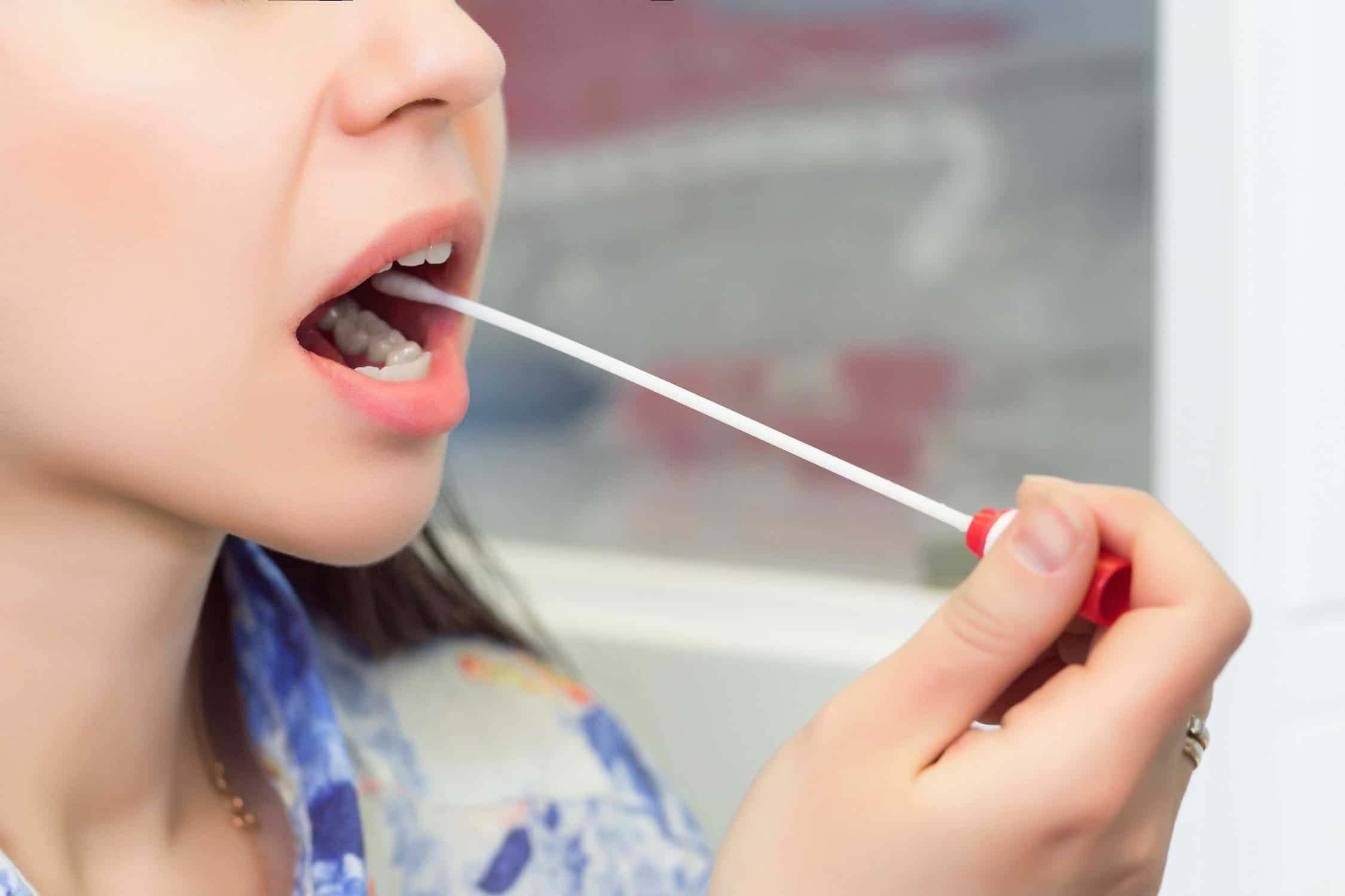 Taking A Sample Of Saliva From The Lips Of A Woman Close Up